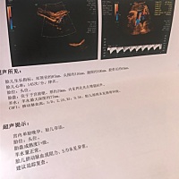 男宝？女宝？好奇🤔