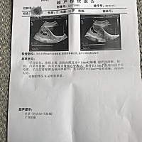 各位麻麻们，能看出女孩还是男孩儿吗？