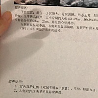 双绒双羊龙凤胎的几率有多少啊，之前还说要问医生是同卵还是异卵，今天才发现双绒双羊就是异卵双胞胎的...