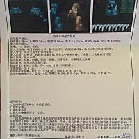 怀孕32周多了，今天检查胎儿脐血流偏高，4.30.怎么办？医生要求治疗后复查！唉，好担心，因为是头胎，没...