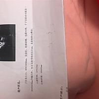 看别人看图片就能看出男女、不知道是男孩女孩啊