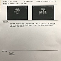 孕7周 5，想问各位，是男是女