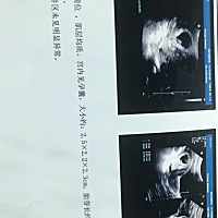 广大朋友帮我看一下这宝宝是男孩女孩？