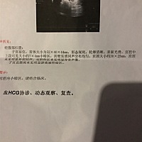 第二胎，有经验的帮忙看看是男是女？第一张B超单是怀孕40几天的，第二张B超单是最近的，60几天快70天的...