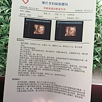 周一，19号就能知道是男宝还是女宝了，大家要不要来猜猜看～等周一回复