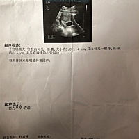 谁会看男女，帮忙看一下，只是好奇，谢谢谢谢