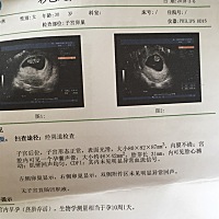 宝妈们帮忙看看是儿子还是女儿😄😄