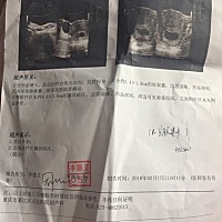 能看出男孩女孩吗？纯属好奇