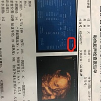 这是今天做的四维彩超单   蓝色报告上写的性别女  是我的性别还是宝宝的呀