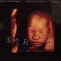 男孩可能性大还是女孩可能性大？