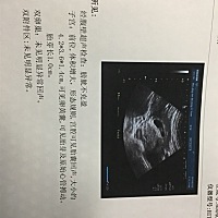 麻烦看看男宝还是女宝，谢谢大家