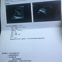 检查一切顺利。能看出男女吗