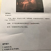 我今天去医院做检查，b超显示有盆腔积液，大家有遇到过怎么治疗吗