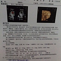 有点小好奇是男是女，有谁会看的吗？