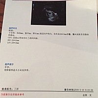 7⃣️周多，50几天，好好奇宝贝是个男宝女宝，有会看的小姐姐吗～