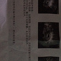 孕七周今天有出血，检查了B超，医生说不能要了