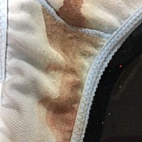 怎么会突然这样😂 现在去医院也要明天才有结果 但是肚子完全没疼痛什么的 好害怕