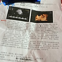 侧脑室后角宽9毫米，医生说10毫米就不能要了，有没有同样情况的宝妈，最后那9毫米被吸收了的