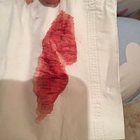 月经推迟六天了！13号去医院抽血化验说是可能怀孕，但是指数很低，可是孕酮也不低呀！测试了🈶️时候...