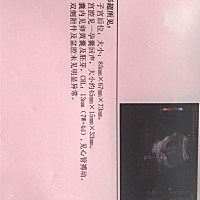 听说看孕囊能辨别是男孩女孩，那就请大神们帮忙看看！