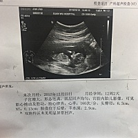 有人会看吗？帮忙看看男宝女宝…很好奇呀。