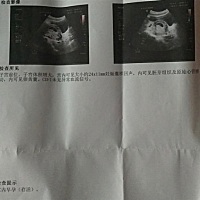 为什么圆球里面有个黑点，像黄瓜一样的？