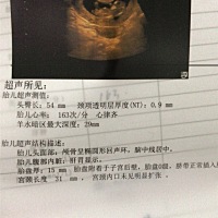 Nt顺利通过，继续好孕