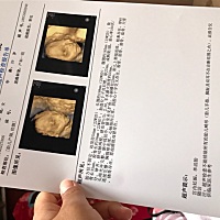 前几天做的四维彩超，第一胎特别好奇是男是女，想让姐妹们帮忙看看是男孩还是女孩！
