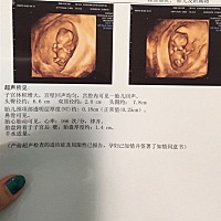 NT顺利通过，好开心！大家帮忙看一下，是男孩还是女孩😄