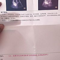 有没有亲能看出是男宝宝还是女宝宝啊？