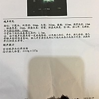 有懂的人帮忙看看，34十4了，股骨长径会变短一点吗？😓😓