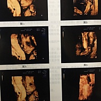 宝妈们谁会看男女啊？ 好想知道