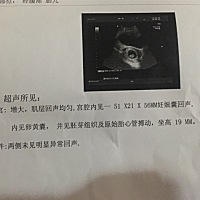 前面检查只有卵黄囊，今天去检查医生说都看到有点在动啦。好开心   祝大家早日有胎芽胎心
