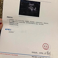 怀孕8周还可以吃叶酸吗？谁帮忙看看能不能看出男女宝