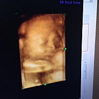 希望你健健康康和爸爸妈妈见面！