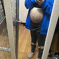 已经33周3天了。妊辰纹那么多怎么办？ 好丑呀