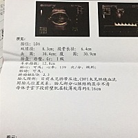 3月16号到19号联系做了4次胎心监护都不过关。感觉胎动还是正常的记录一下大概一个小时5 次。今天医生建...
