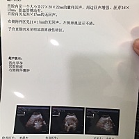 大家帮忙看看，怎么回事，每次检查都会出现一个新问题