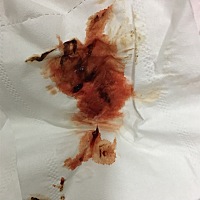 40天 今天早上起床 柳血有点多 会不会是流产了 宝妈们 求助啊 特担忧