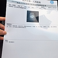 孕12周。正常吗