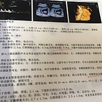 有没有会男女的，求男女咯