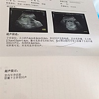 亲们帮忙看看是男宝还是女宝，我想要个女宝