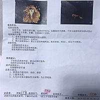 有跟我一样情况的宝妈吗  ？  昨天拿到报告  ，做的造影  医生的话   让我瞬间跌落谷底 ， 结婚一年了  ...