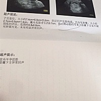 有点出血，保胎中，看彩超能看出男女宝吗？想要个女宝