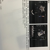 二胎宝宝，37周了，大家帮忙看看像男宝还是女宝，蛮好奇的。