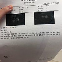 48天，有胎心胎芽了