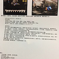 还有一个月就要卸货啦，大家看看是男宝还是女宝