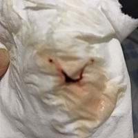 怀孕3个月20天出现血丝，是不是妇科炎症引起的啊