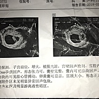 能看出来这个男孩女孩吗？