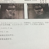 大家帮我看看是男宝还是女宝